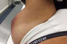 Luis Moya sufre un accidente cuando circulaba en moto accidente-motor-luis-moya